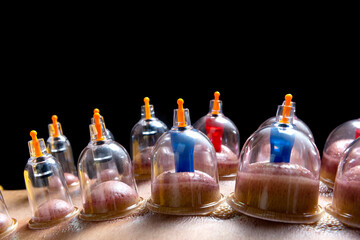 Man with cupping treatment on the back