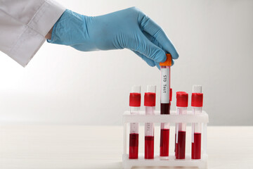 Scientist taking tube with blood sample and label STD Test from rack at white table, closeup