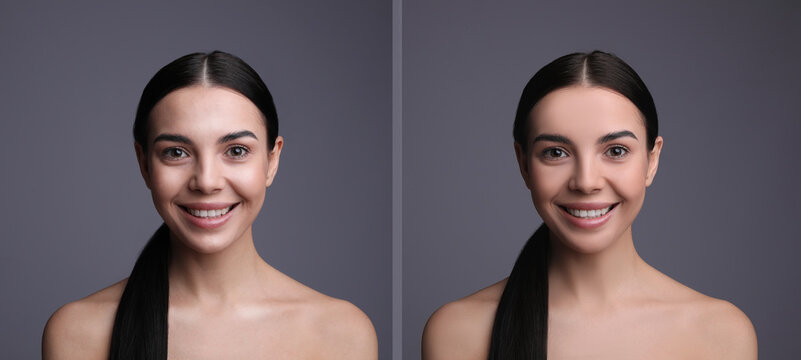 Collage with photos of beautiful young woman before and after using mattifying wipes on grey background. Banner design
