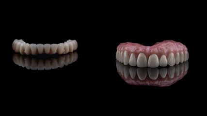 dentures on a black background, dental implants	
