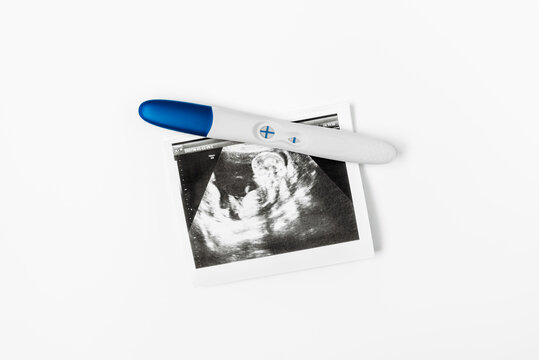 Positive pregnancy test on ultrasound photo. A positive pregnancy test result. Pregnancy test showing a positive result. Ultrasound photos of the child. Copy space