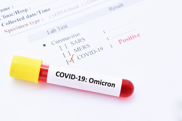 Omicron positive, blood sample tube positive with Omicron or B.1.1.529 variant of COVID-19 coronavirus