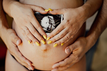 the hands of a man and a woman hold an ultrasound of their child on stomach