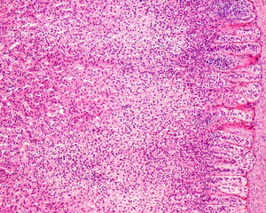 Human adrenal gland cortex