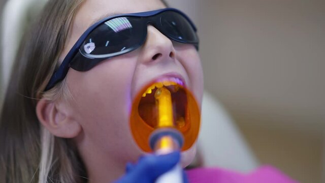 Close-up dental UV curing light in doctor hand with teenage patient in dentist chair. Unrecognizable professional orthodontist doing dental resin polymerization in oral cavity in slow motion