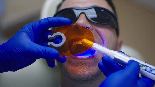 Headshot man in sunglasses with male doctor hands in gloves using UV curing light for dental resin polymerization. Close-up face Caucasian male patient in dental chair in clinic. Slow motion