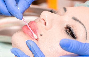 Lip augmentation. Beautician injects hyaluronic acid into the lips of a girl with a syringe. The...