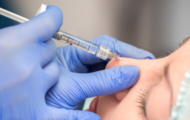 Cosmetic procedure for non-surgical rhinoplasty. Beautician injects hyaluronic acid into the nose...