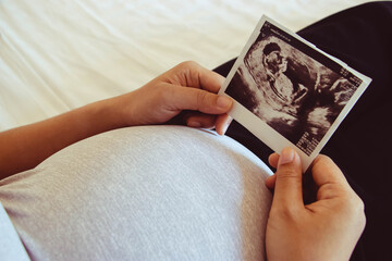 Close up of pregnant woman holding a sonogram while sitting on bed.
