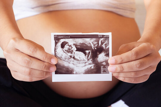 Close up of pregnant woman holding a sonogram while sitting.