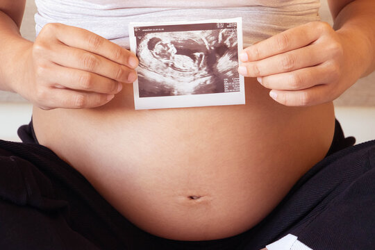 Close up of pregnant woman holding a sonogram while sitting.