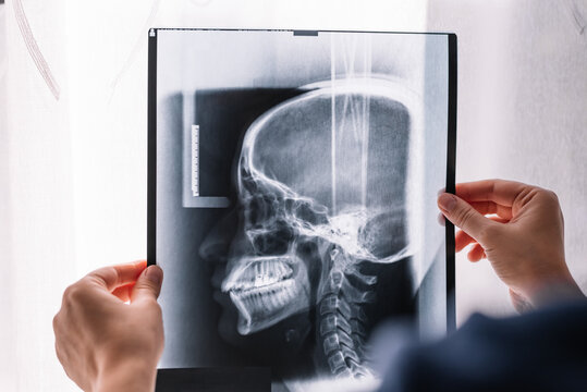 Doctor examining a head x-ray