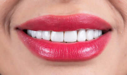 Fototapeta premium beautiful white smile with lipstics