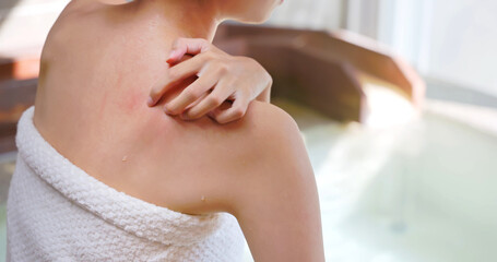 scratches shoulder in hot spring