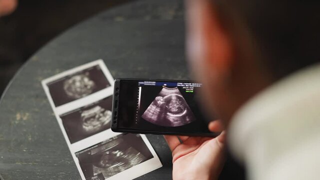 Happy future parents enjoy baby ultrasound record via phone