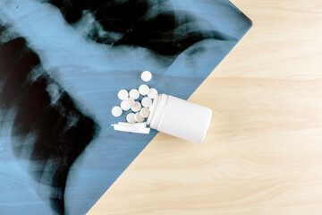 Lung X-ray blister with pills on the table with copyspace