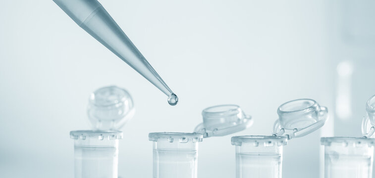 Pipette and test tubes in a microbiological laboratory