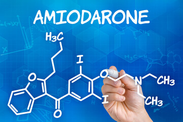 Hand with pen drawing the chemical formula of Amiodarone