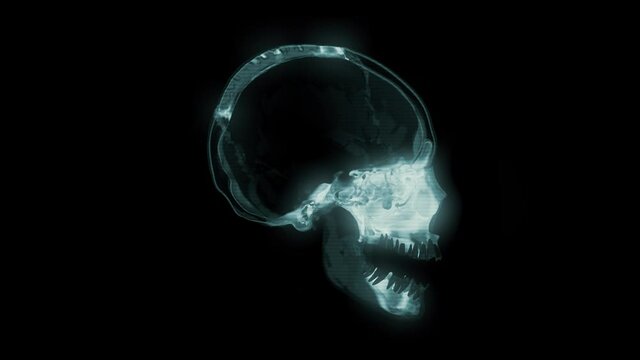 CT Scan of Head and Skull, CG animation