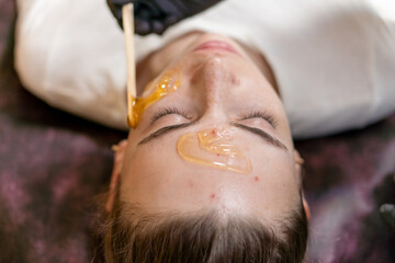 Applying the hydrogel to the girl's face before cleansing her face.