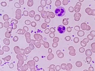 Blood smear microscopic show platelet, neutrophil, red blood cell and polychromatic in the...