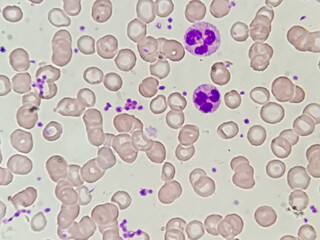 Blood smear microscopic show platelet, neutrophil, red blood cell and polychromatic in the...