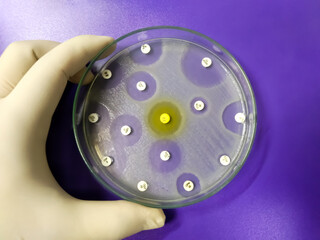 Antimicrobial susceptibility testing in petri dish. Antibiotic resistance of bacteria