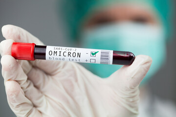 Obraz premium Doctor medical worker holding test tube specimen holder containing Omicron variant Coronavirus patient blood sample