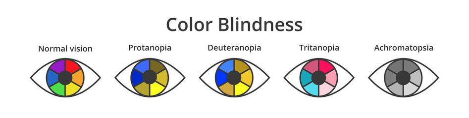 Vector set of icons or symbols of eyes with color blindness or colorblindness isolated on white. Normal vision, protanopia, tritanopia, deuteranopia, achromatopsia. Decreased ability to see colors. - obrazy, fototapety, plakaty