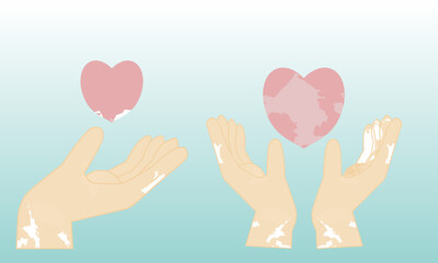Vector illustration on the theme of donation, charity, mutual help, welfare. It is watercolor processed.