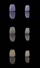 Two dental ceramic crowns of the upper jaw after milling, sintering and after painting. Aesthetic dentistry.