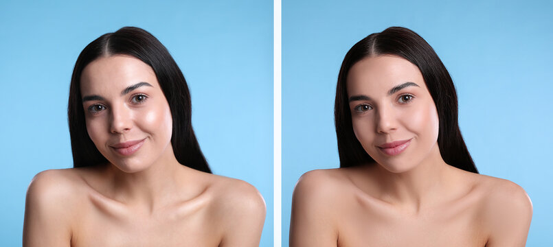Collage with photos of beautiful young woman before and after using mattifying wipes on light blue background. Banner design