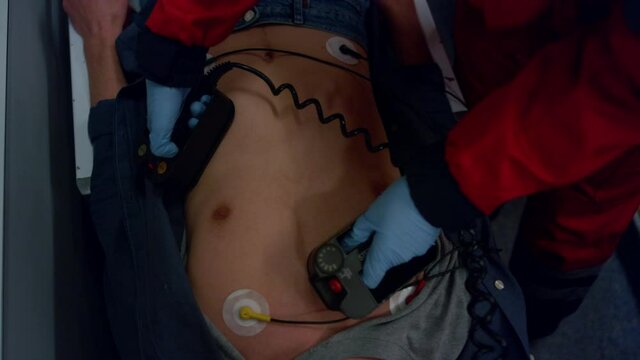 Paramedic hands using defibrillator. Doctor giving first aid help to man