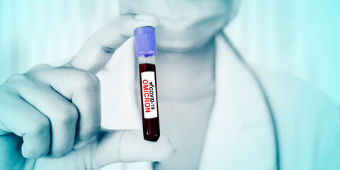 Doctor holds infected blood of omicron variant