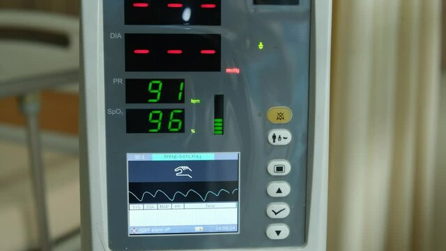 Low light handheld footage with noise effect added of vital sign monitor used in a hospital.