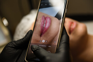 Close up photo of lips on smartphone screen, cosmetologist  taking picture of lips, process of...
