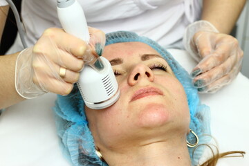 Beauty salon. A cosmetologist in medical gloves and protective mask doing a hydra peeling procedure on the client's cheeks. Side view. Close up. Professional skin care during coronavirus pandemic.