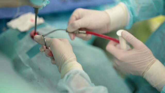 endoscopic endonasal surgery, modern medical technology