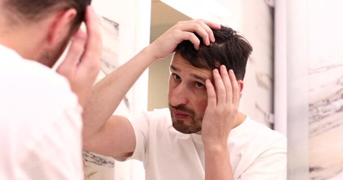 Bearded man standing in front of mirror and looking at his thinning hair, bald.