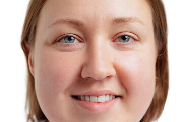 Close-up portrait of woman. Female face without makeup. Anti-aged cosmetology, well-kept skin, medicine and health.