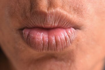 Obraz premium Closeup of female dry and cracked lips, skin care concept
