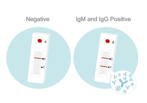 The interpretation of antibody (IgM and IgG) rapid test kit result that is lateral flow test (immunochromatography technique) or serology test.

