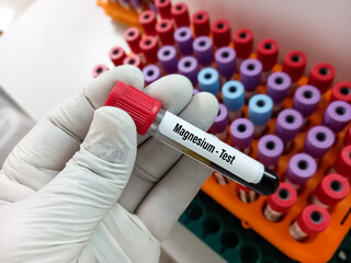 Test tube with blood sample for magnesium test, close and focus view