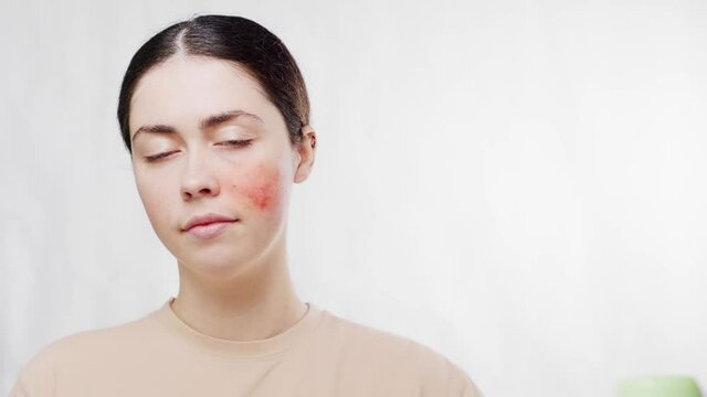 Skin care. A young beautiful woman with a red cheek is offered a face cream, but she refuses. The concept of cosmetology and rosacea