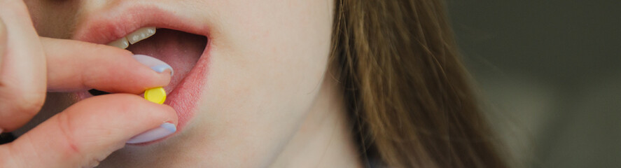 the yellow pill lies on the woman's red tongue. mouth close-up. disease and treatment concept. skin