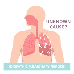 Capillary dry cough of wood metal dust breath virus Chest X-ray Cancer scan High resolution HRCT Biopsy usual COPD chronic asbestos corona covid 19 cystic diagnose disorder dyspnea fibers ILD UIP IPF