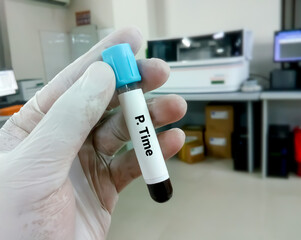 Blood sample for P. Time test. coagulation factor testing, diagnosis of bleeding disorder