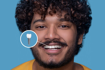 Young man with a toothy smile demonstrating his dental implant - obrazy, fototapety, plakaty