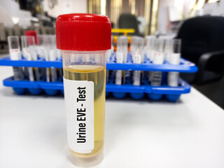 Urine specimen container with sample for Urine EVE test, laboratory background