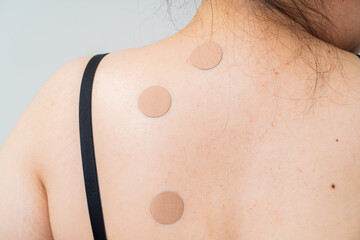 Women back with back pain patch